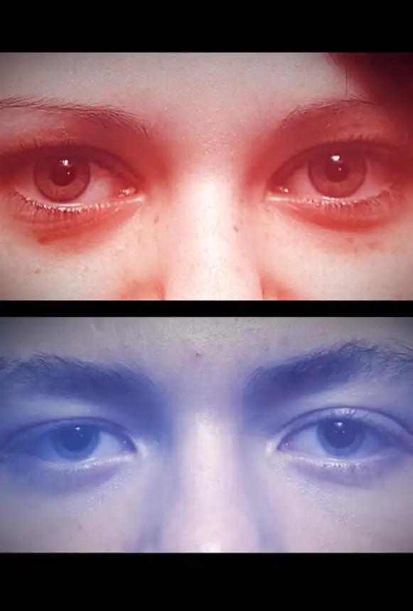 Alles Mädchen, alles Junge