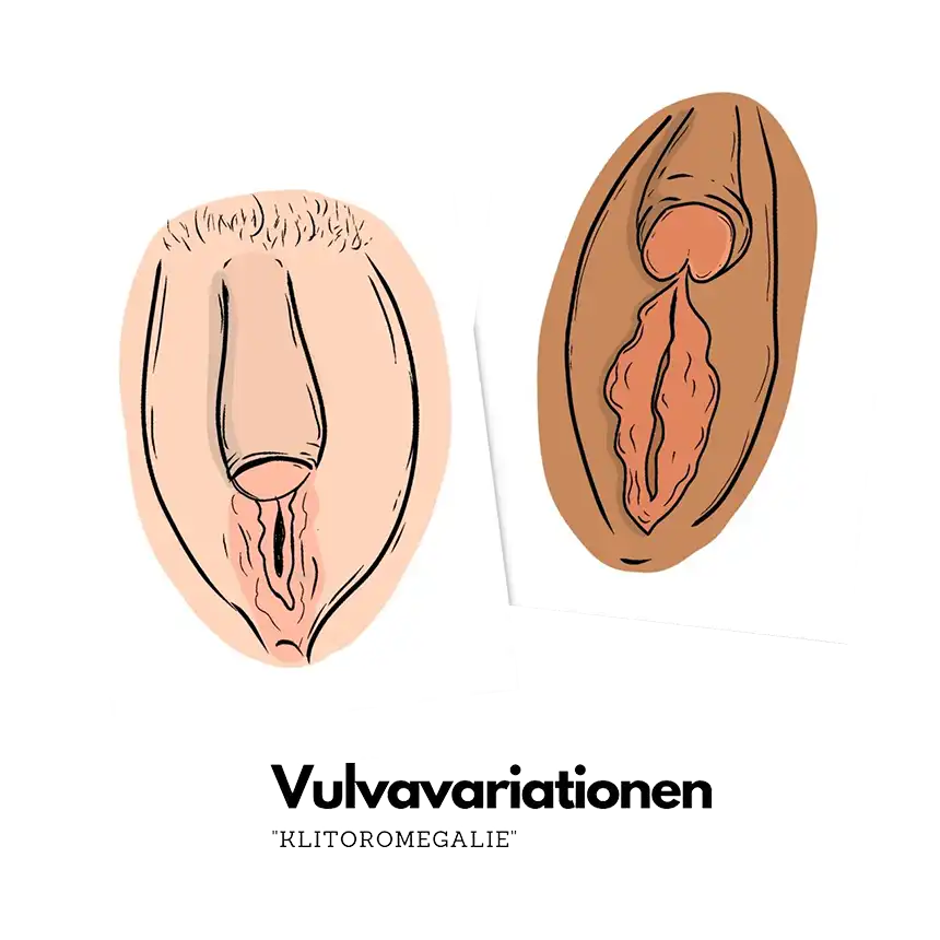 Vulva Penis Inter*