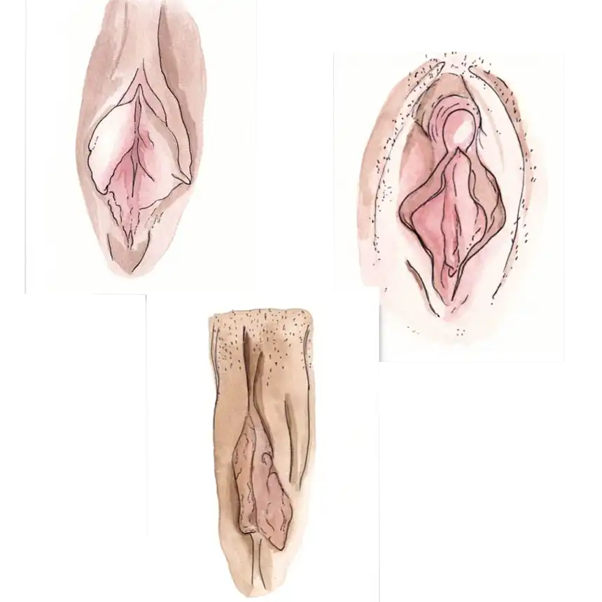 Geni(t)ale Vielfalt Geni(t)ale Vielfalt